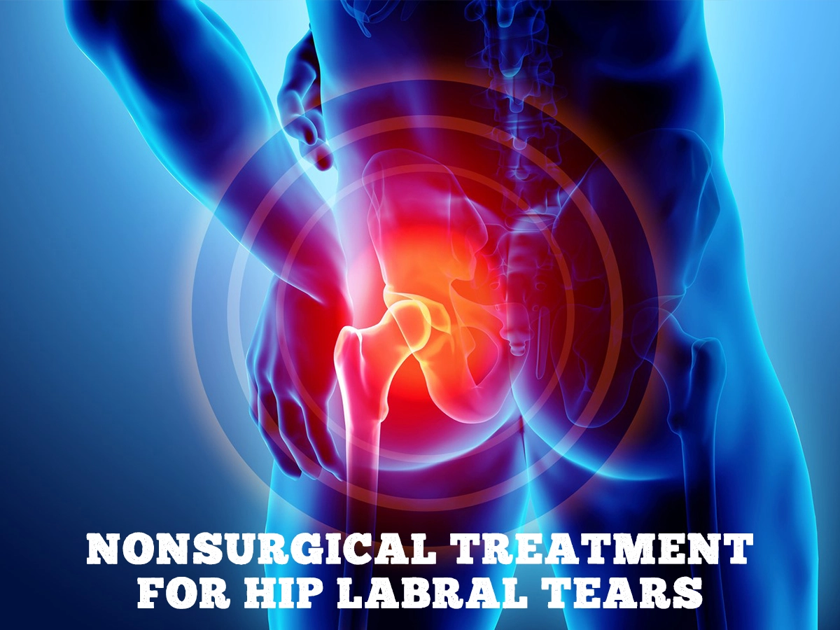 Nonsurgical Treatment For Hip Labral Tears