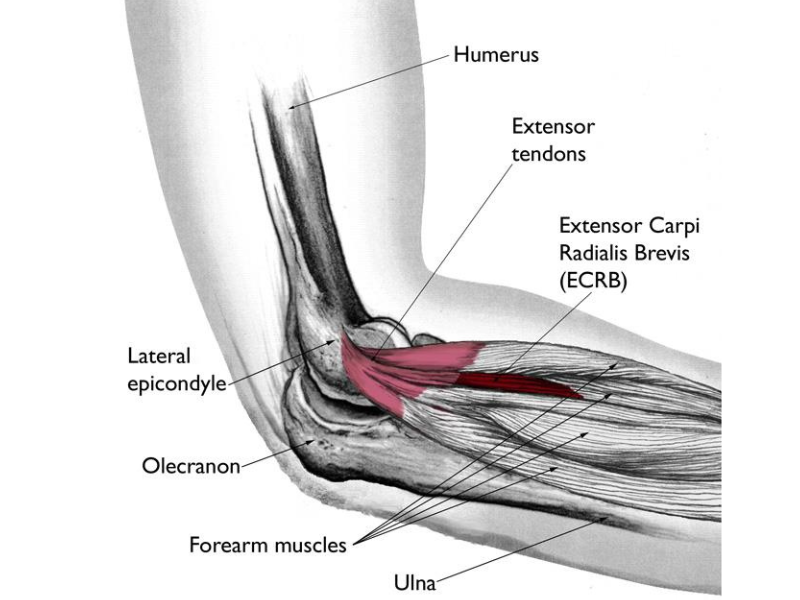 Diagnosis of Elbow Pain