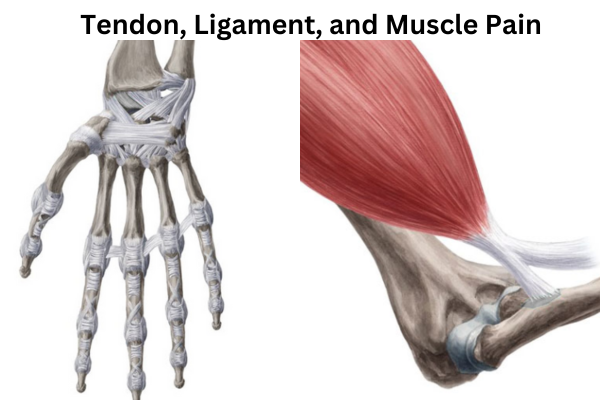 Tendon, Ligament, and Muscle Pain