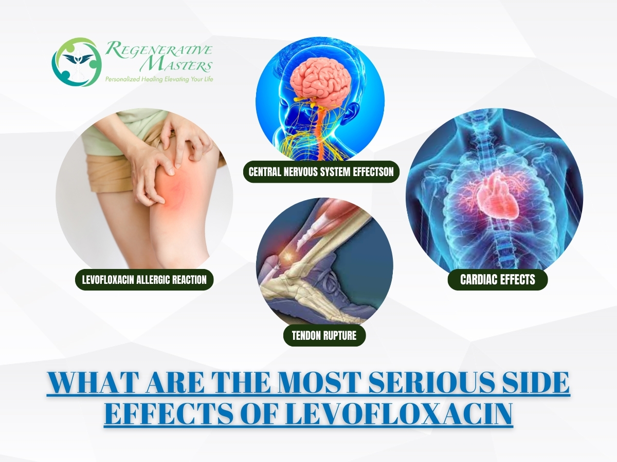 Most Serious Side Effects of Levofloxacin